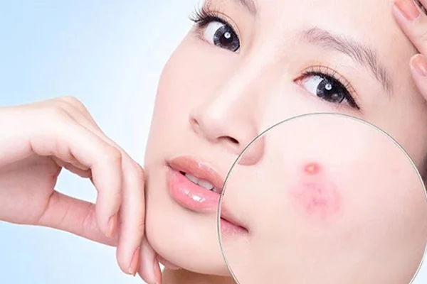 Uống sâm bông cúc